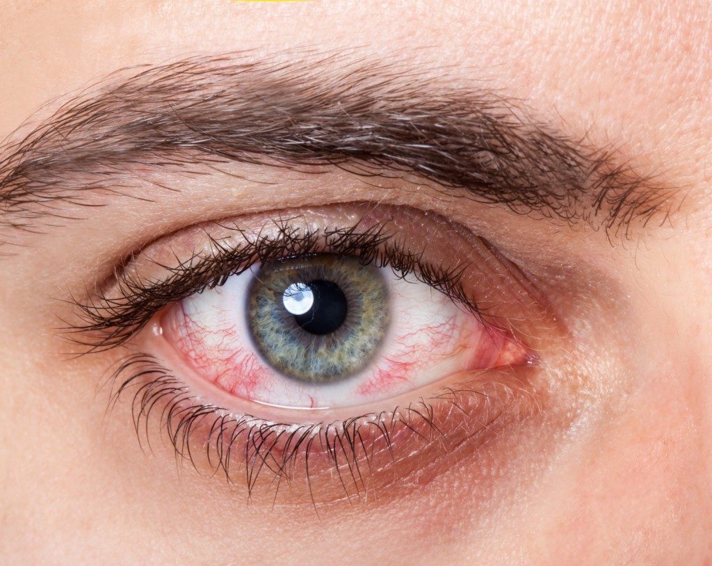 What is the main cause of dry eyes